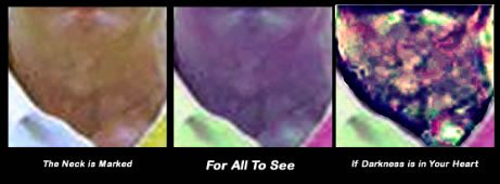 The Neck Is Marked For All To See The Evil Deeds