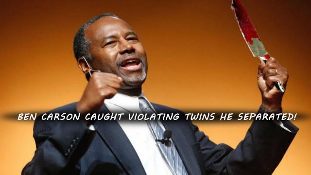 BEN CARSON CAUGHT VIOLATING TWINS HE SEPARATED!