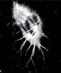 B4INREMOTE-aHR0cDovLzMuYnAuYmxvZ3Nwb3QuY29tLy1pVi0ySDdBNmJHZy9VTlZnckFzVHdmSS9BQUFBQUFBQU1IZy8yQlkyWDZ5UVVKMC9zNjQwL3VmbytzcXVpZCsyLkpQRw==