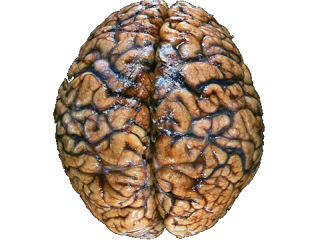 B4INREMOTE-aHR0cDovLzEuYnAuYmxvZ3Nwb3QuY29tLy1QS3E0SmlvZGJCOC9VTlF2UF94dXRwSS9BQUFBQUFBQUVxUS9qTUd4bHNLVlgxUS9zMzIwL3dhbG51dC5wbmc=