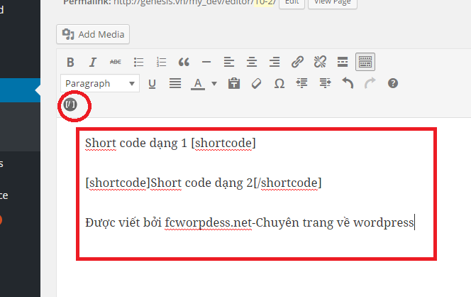 ket qua them button vao editor tinymce